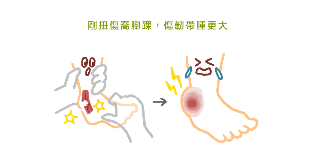 足踝扭傷怎麼辦?復健科醫師:急性發炎的 PRICE 處理法 - Bestmade 人學院