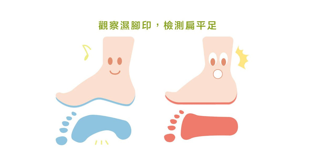 你有扁平足嗎？扁平足矯正運動指南 - Bestmade 人學院