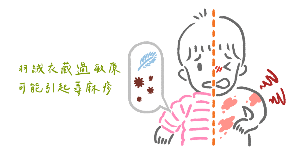 寶寶長蕁麻疹，罪魁禍首居然是「它」！ - Bestmade 人學院