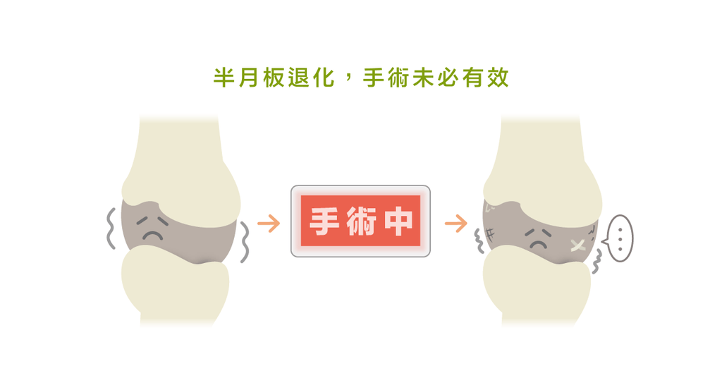 進手術房卻不真的開刀？假手術竟然也能改善膝蓋的問題？ - Bestmade 人學院