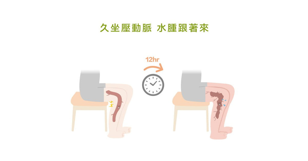 水腫大家都聽過，那麼，什麼是靜脈水腫呢？ - Bestmade 人學院