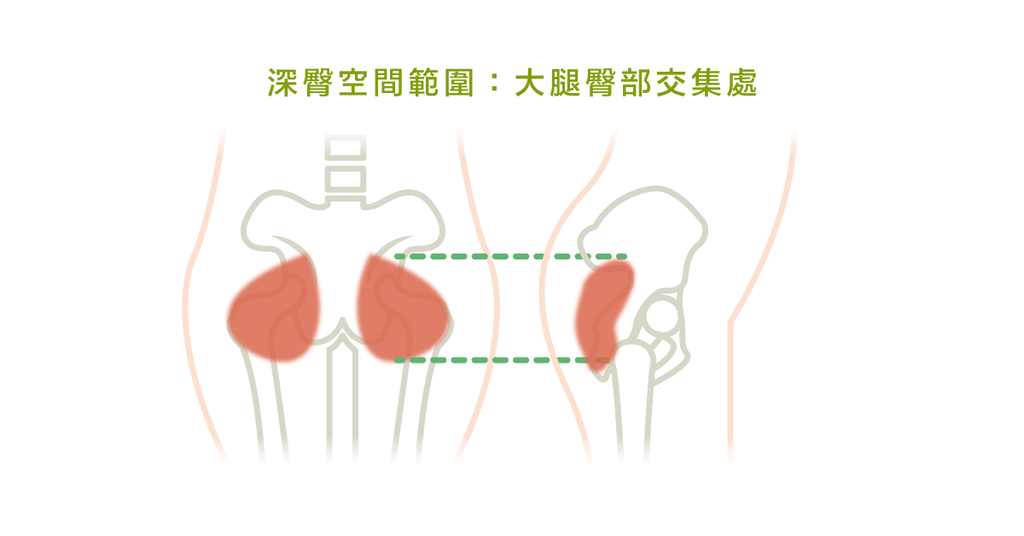 還在用「梨狀肌症候群」這個名詞嗎？已經過時囉！ - Bestmade 人學院