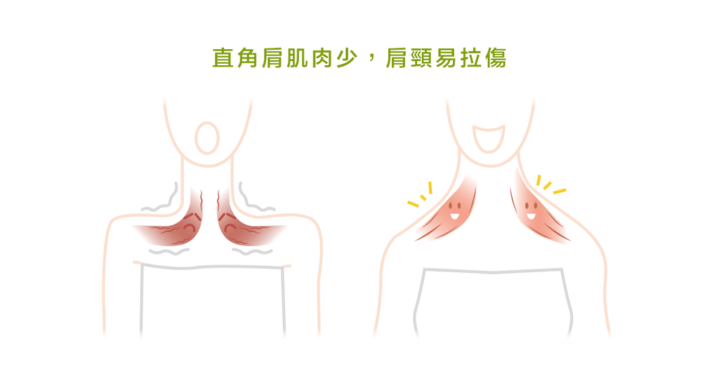 直角肩的迷思－－女生一定要有直角肩才好看嗎？ - Bestmade 人學院