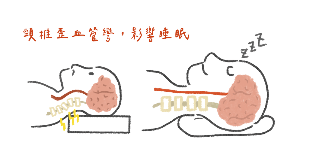 你以為的失眠，可能是頸椎出了問題！ - Bestmade 人學院
