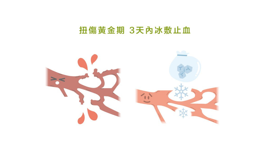 運動受傷時的處理方式－－PRICE - Bestmade 人學院